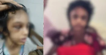 ‎বিমানের এমডির বাসায় নির্যাতনের শিকার গৃহকর্মী চিকিৎসা শেষে বাবার জিম্মায়